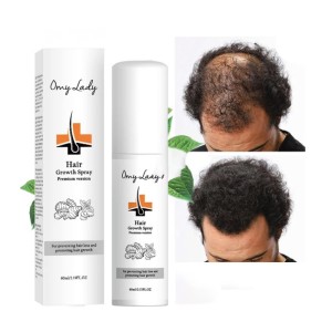 Spray For Hair Growth, Against Hair Loss Omy Lady Hair Growth Spray, 60ml
