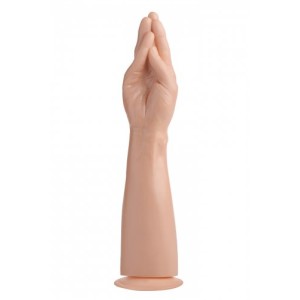 Xr Ms The Hand And Forearm